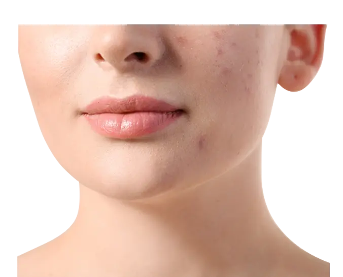 Before Skin Solution