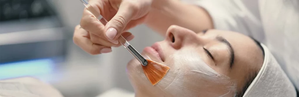 chemical-peels