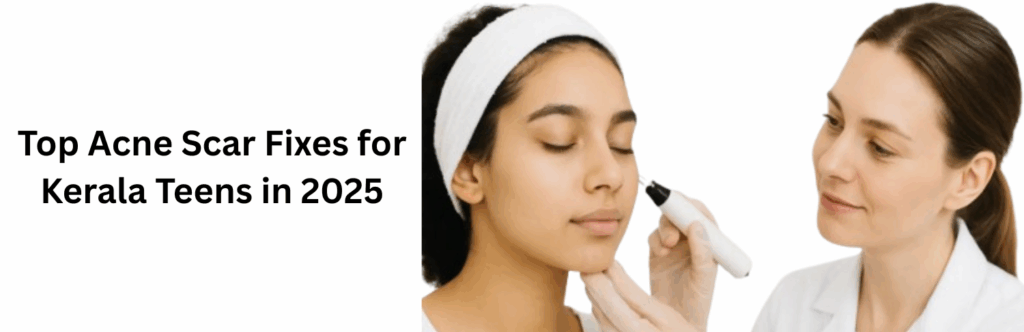 Top Acne Scar Fixes for Kerala Teens in 2025