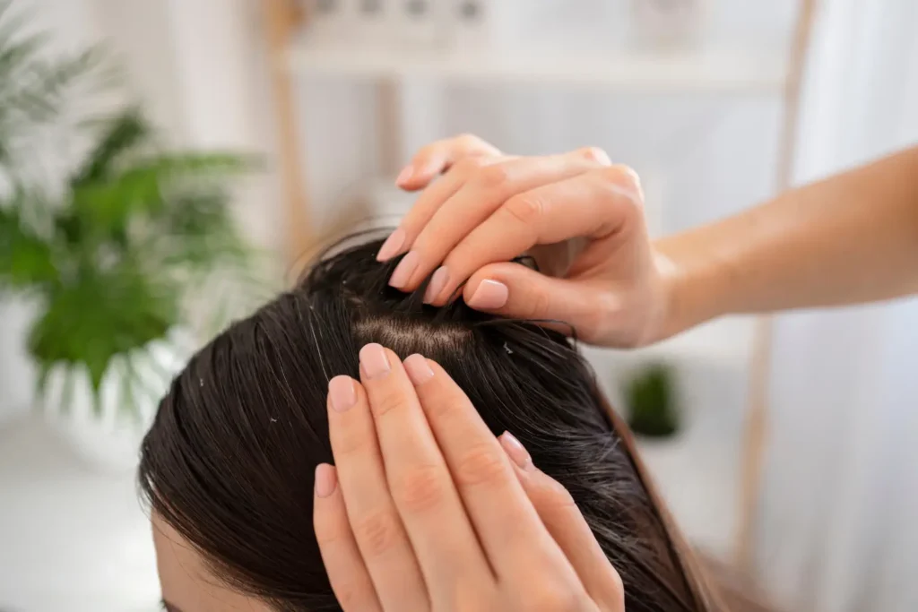Dandruff Treatment