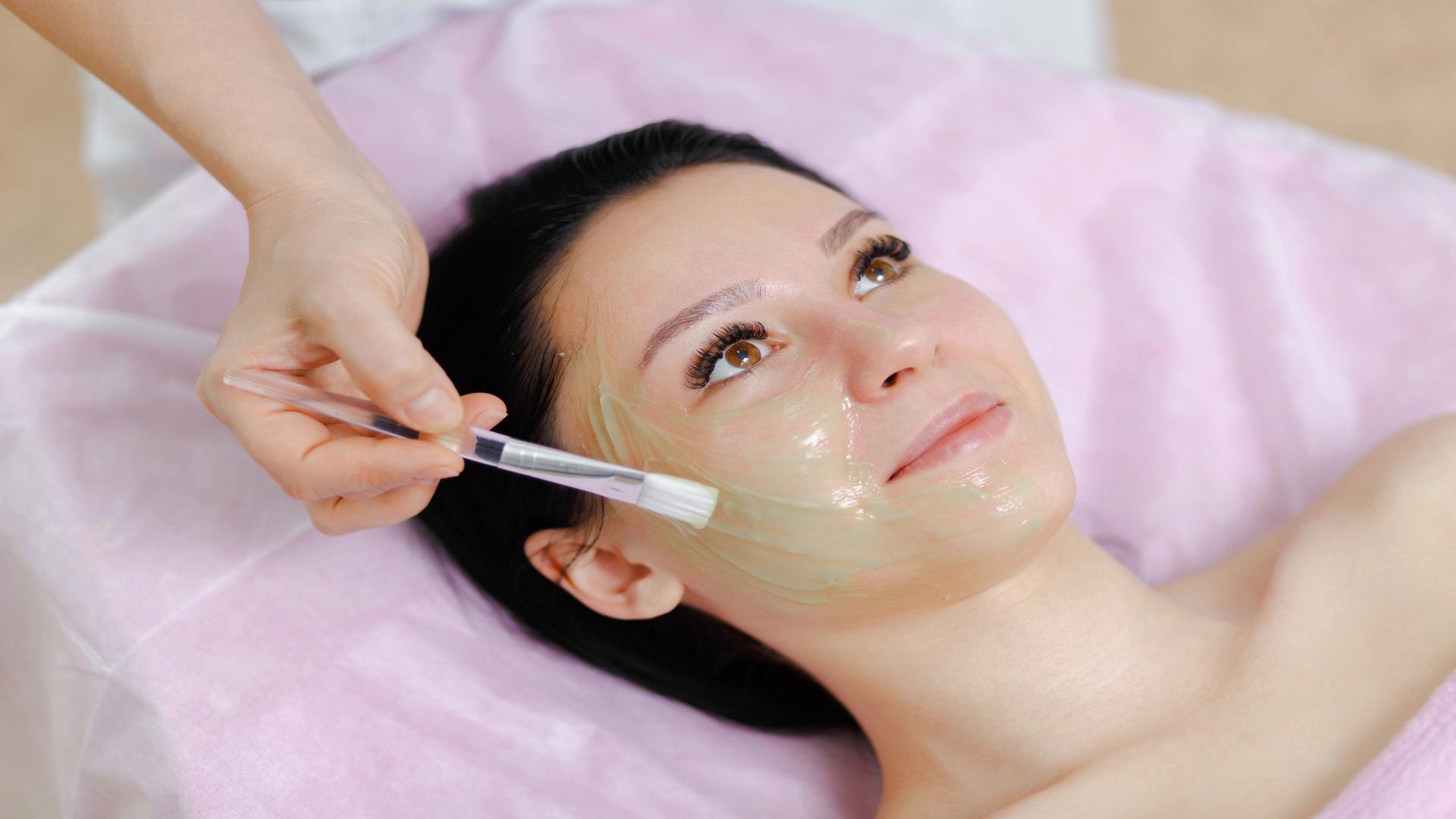 chemical peel treatment