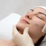 Filler Treatments in Calicut for Facial Concerns